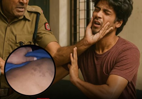 MP के छतरपुर में पुलिस पर बर्बरता के आरोप, युवकों ने लगाया अमानवीयता का दावा