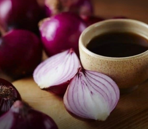 बालों के झड़ने से परेशान? प्याज़ का रस बना रामबाण इलाज!