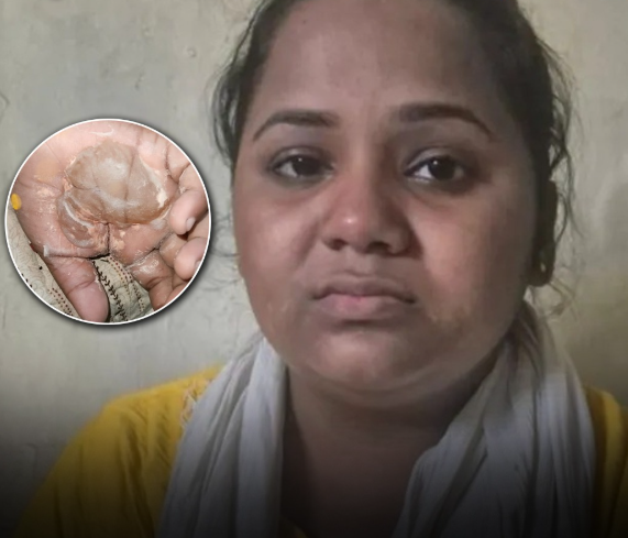 मासूम की लिखावट खराब थी, टीचर ने जला दिया हाथ — मुंबई में ट्यूशन टीचर की हैवानियत